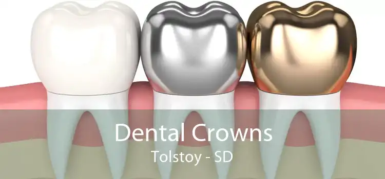 Dental Crowns Tolstoy - SD