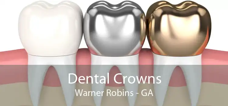 Dental Crowns Warner Robins - GA