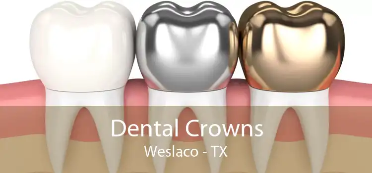 Dental Crowns Weslaco - TX