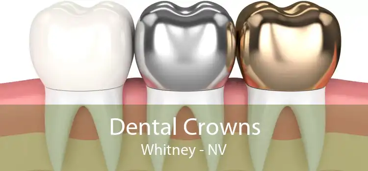 Dental Crowns Whitney - NV