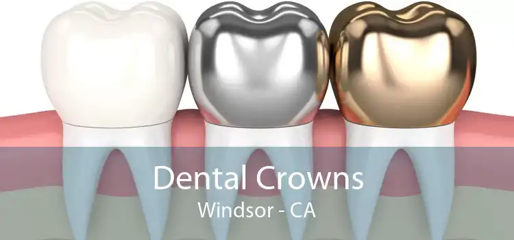 Dental Crowns Windsor - CA