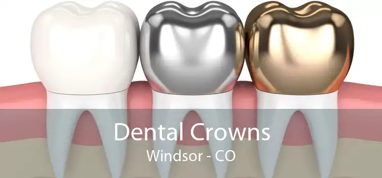 Dental Crowns Windsor - CO