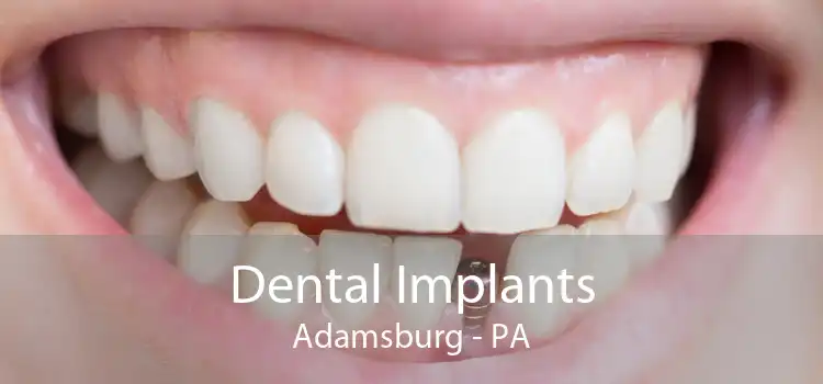 Dental Implants Adamsburg - PA