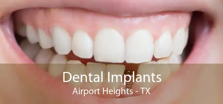 Dental Implants Airport Heights - TX