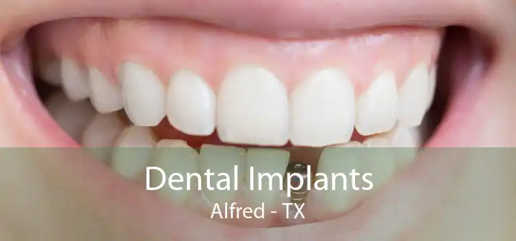 Dental Implants Alfred - TX