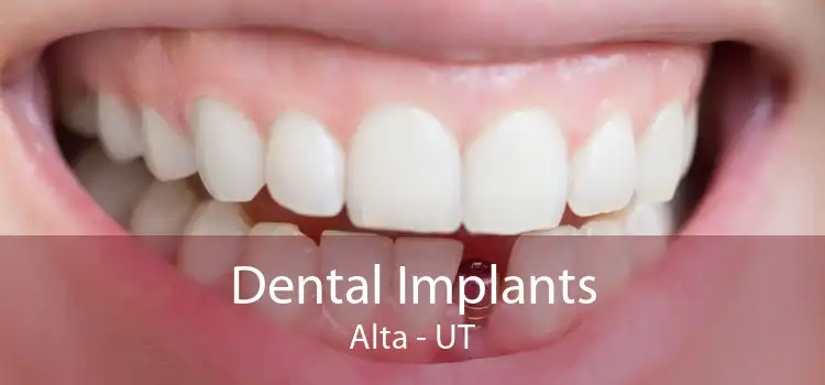 Dental Implants Alta - UT