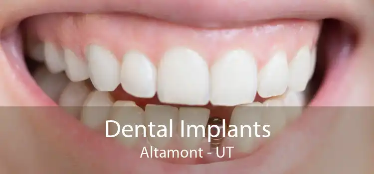 Dental Implants Altamont - UT