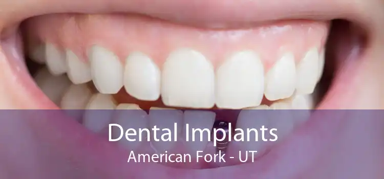 Dental Implants American Fork - UT