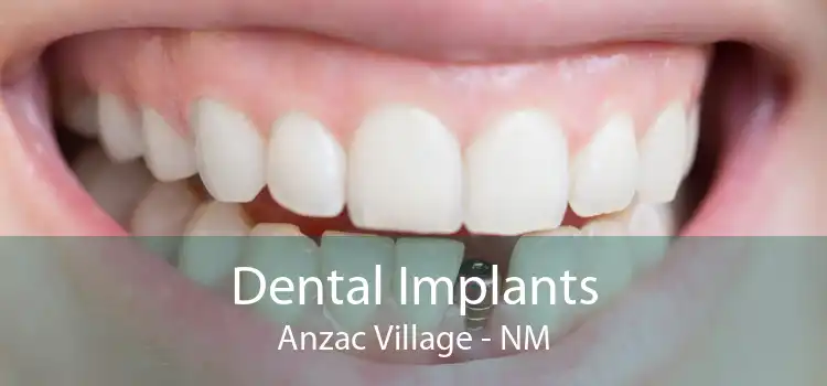 Dental Implants Anzac Village - NM