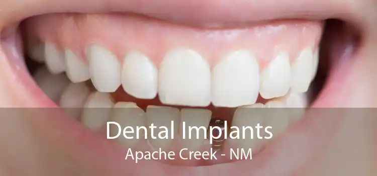 Dental Implants Apache Creek - NM