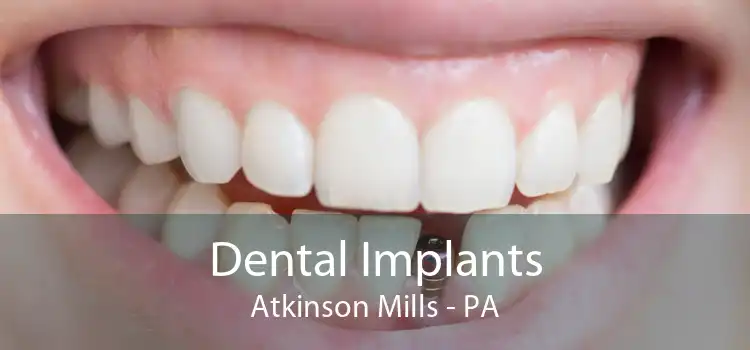 Dental Implants Atkinson Mills - PA