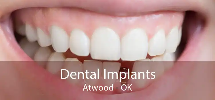 Dental Implants Atwood - OK