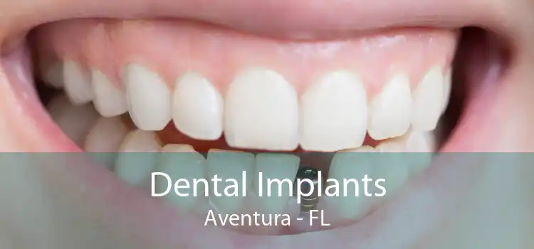 Dental Implants Aventura - FL