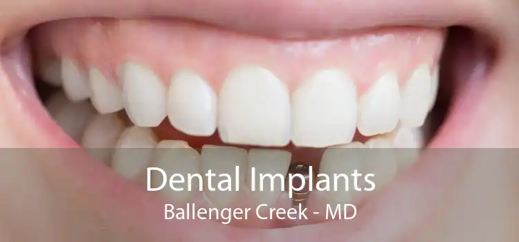 Dental Implants Ballenger Creek - MD