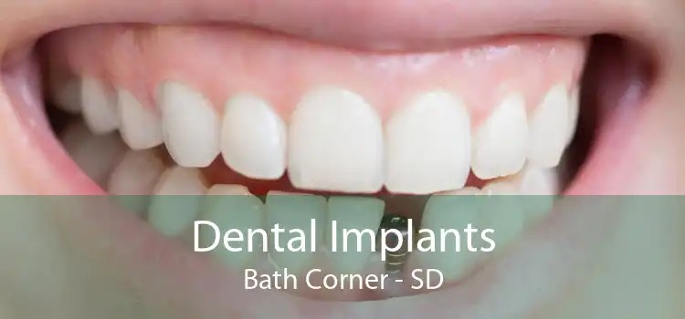 Dental Implants Bath Corner - SD