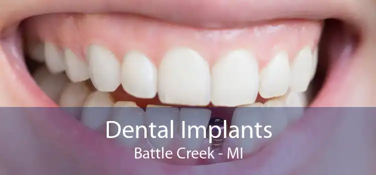 Dental Implants Battle Creek - MI