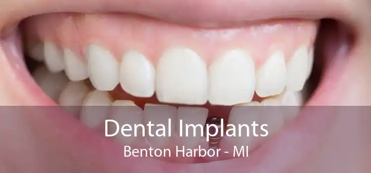 Dental Implants Benton Harbor - MI