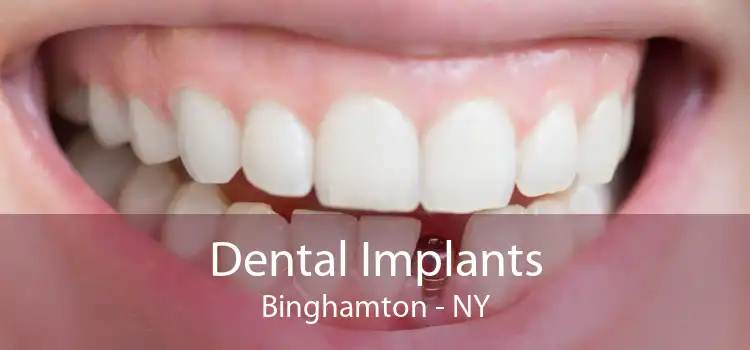 Dental Implants Binghamton - NY