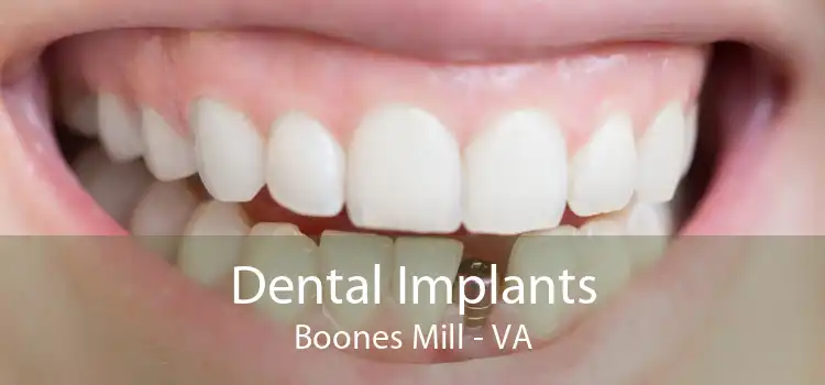 Dental Implants Boones Mill - VA