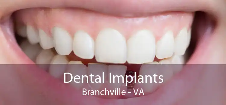 Dental Implants Branchville - VA