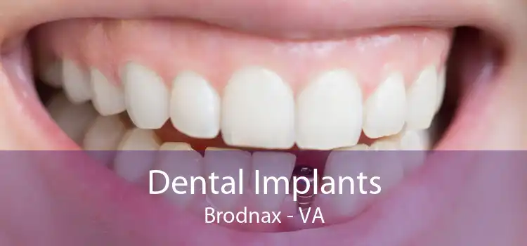 Dental Implants Brodnax - VA