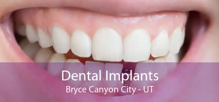 Dental Implants Bryce Canyon City - UT