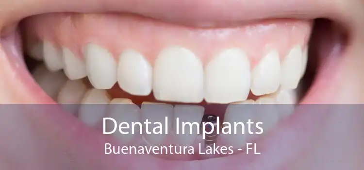 Dental Implants Buenaventura Lakes - FL