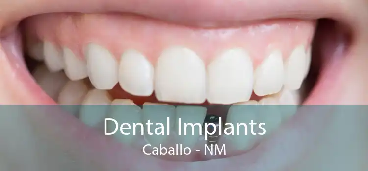 Dental Implants Caballo - NM