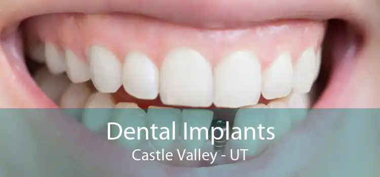 Dental Implants Castle Valley - UT