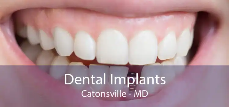 Dental Implants Catonsville - MD