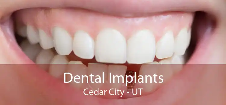 Dental Implants Cedar City - UT