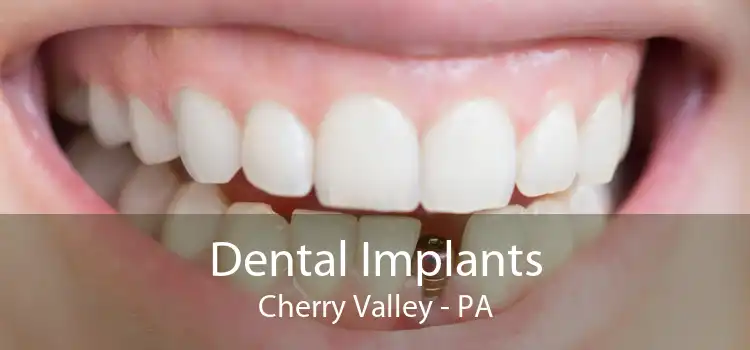 Dental Implants Cherry Valley - PA