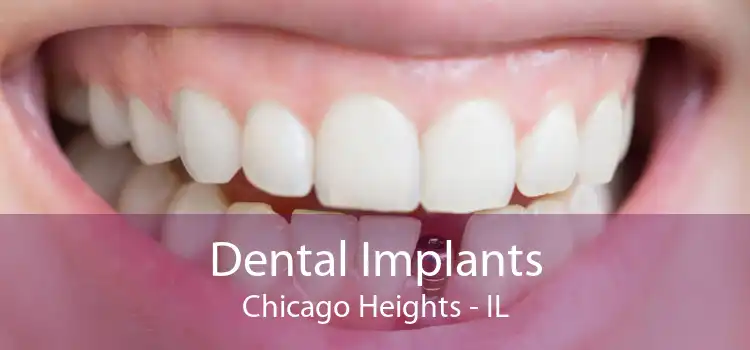 Dental Implants Chicago Heights - IL