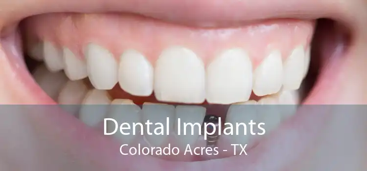 Dental Implants Colorado Acres - TX