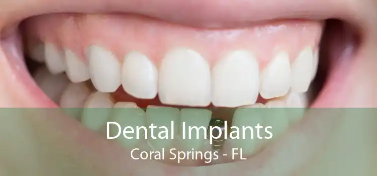 Dental Implants Coral Springs - FL