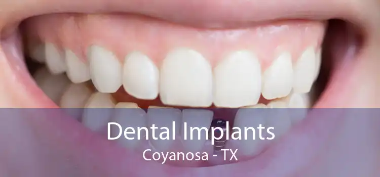 Dental Implants Coyanosa - TX
