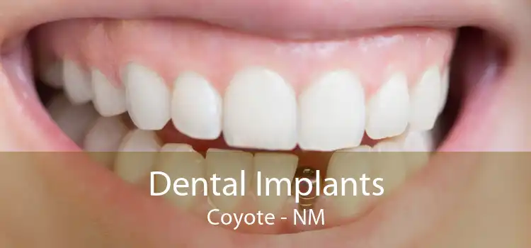 Dental Implants Coyote - NM