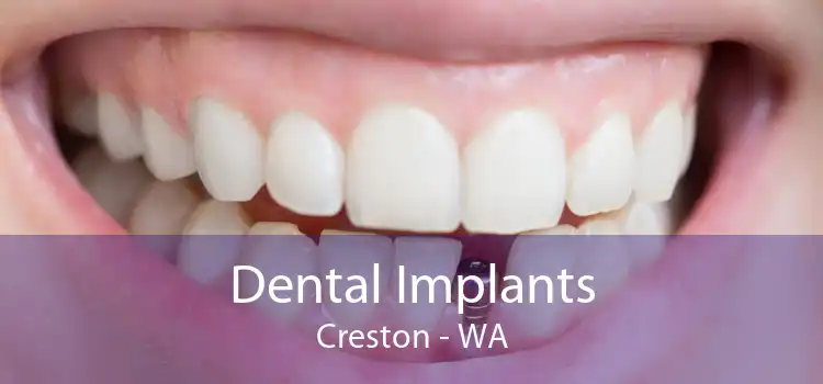 Dental Implants Creston - WA