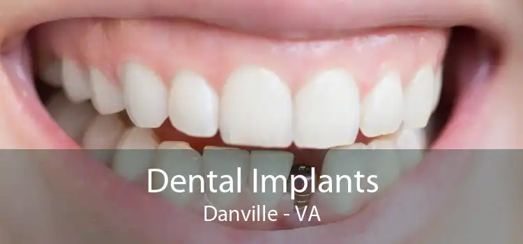 Dental Implants Danville - VA
