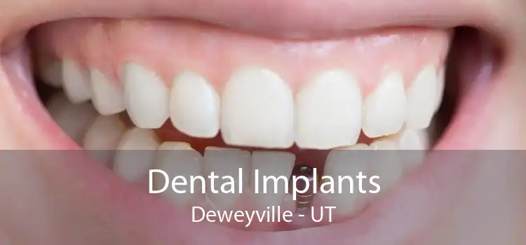 Dental Implants Deweyville - UT