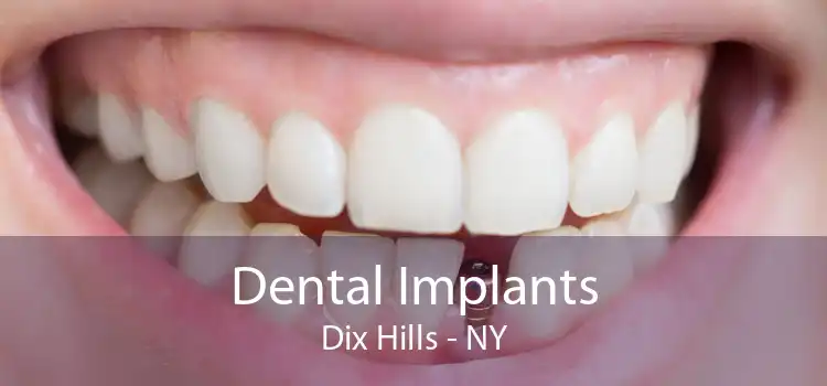 Dental Implants Dix Hills - NY