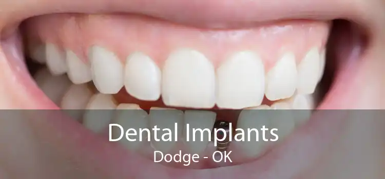 Dental Implants Dodge - OK
