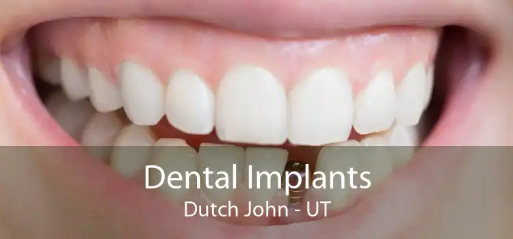Dental Implants Dutch John - UT