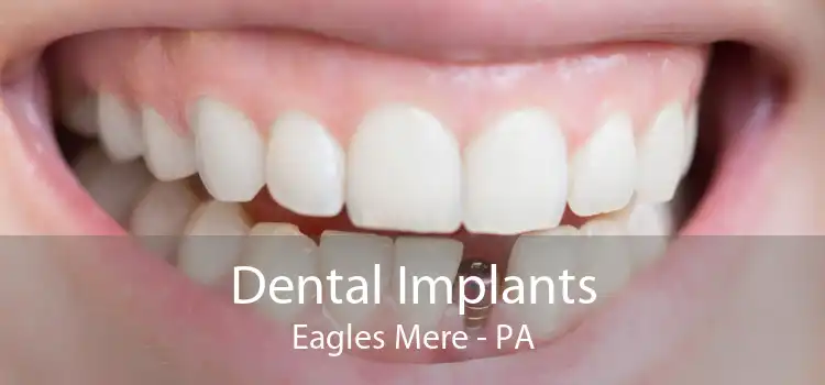 Dental Implants Eagles Mere - PA