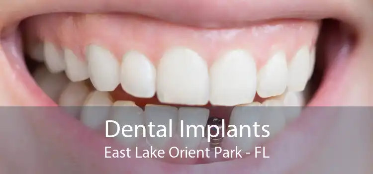 Dental Implants East Lake Orient Park - FL