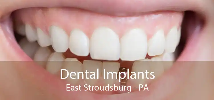Dental Implants East Stroudsburg - PA