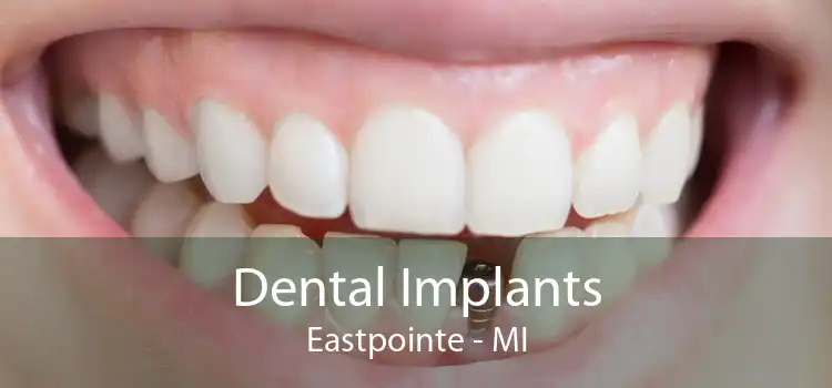Dental Implants Eastpointe - MI