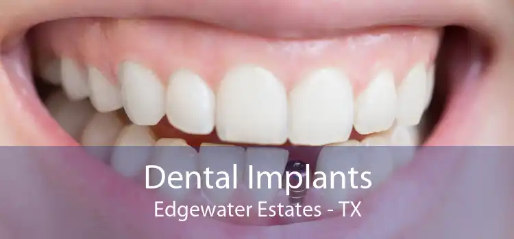 Dental Implants Edgewater Estates - TX