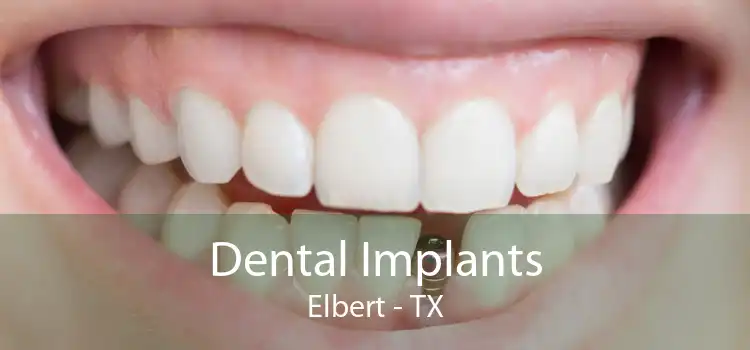 Dental Implants Elbert - TX