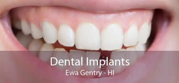 Dental Implants Ewa Gentry - HI